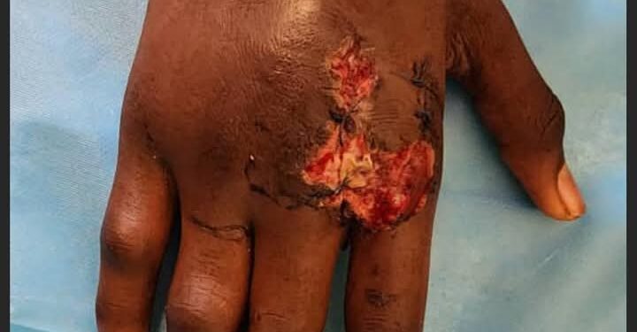 Affaire école Sainte-Marie: pourquoi l’école et l’hôpital Donka cherchent à étouffer l’affaire ?